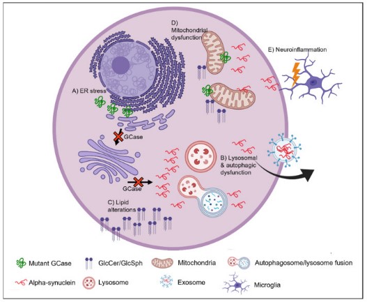 Possible mechanisms underlying the link between GCase, alpha-synuclein and PD.jpg